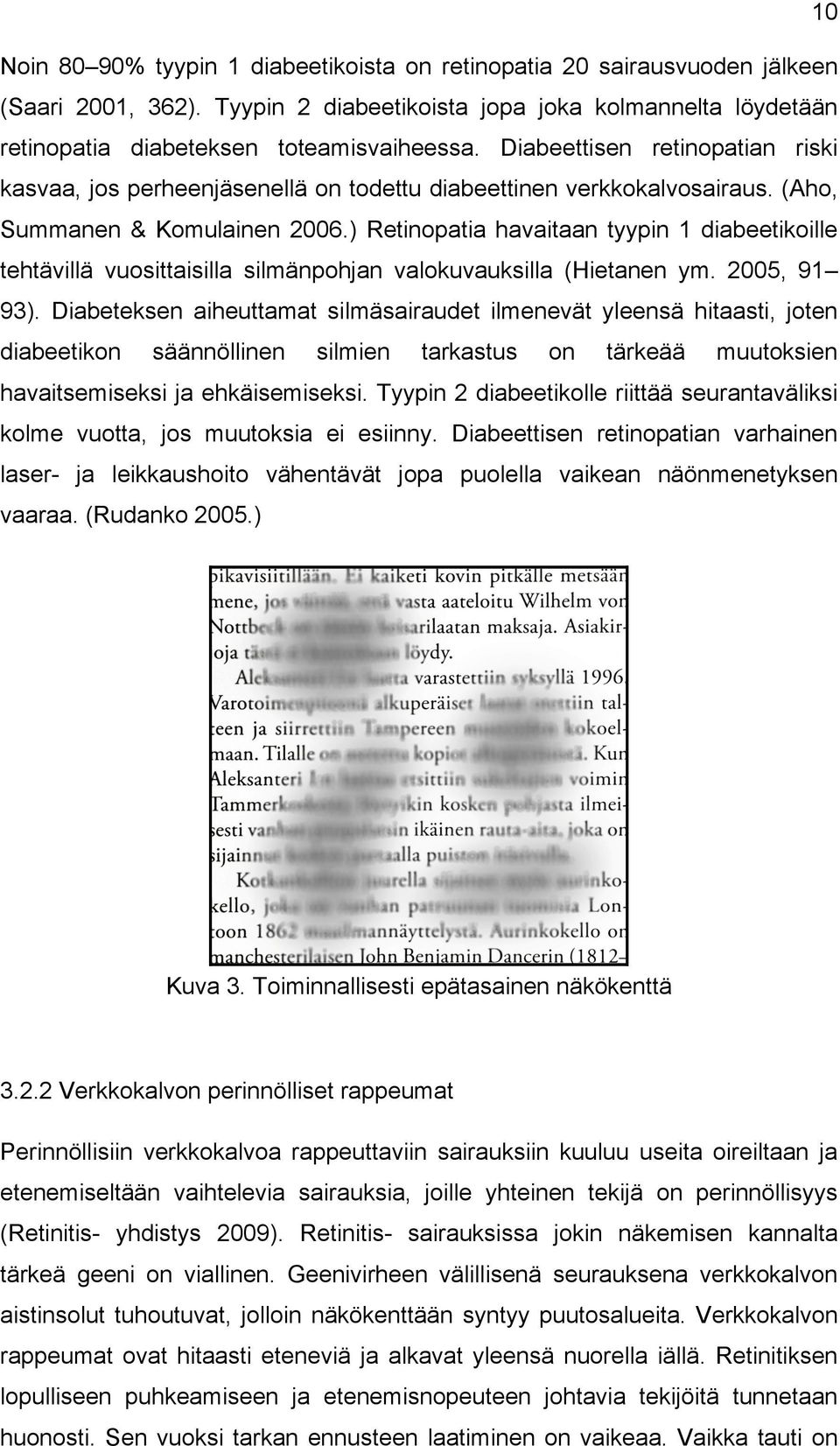 ) Retinopatia havaitaan tyypin 1 diabeetikoille tehtävillä vuosittaisilla silmänpohjan valokuvauksilla (Hietanen ym. 2005, 91 93).