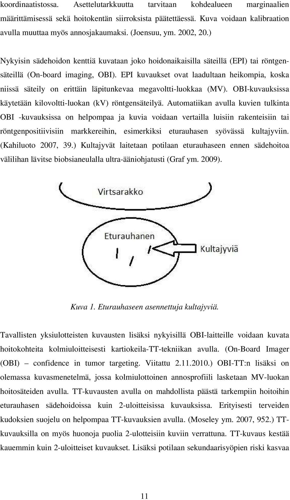 EPI kuvaukset ovat laadultaan heikompia, koska niissä säteily on erittäin läpitunkevaa megavoltti-luokkaa (MV). OBI-kuvauksissa käytetään kilovoltti-luokan (kv) röntgensäteilyä.