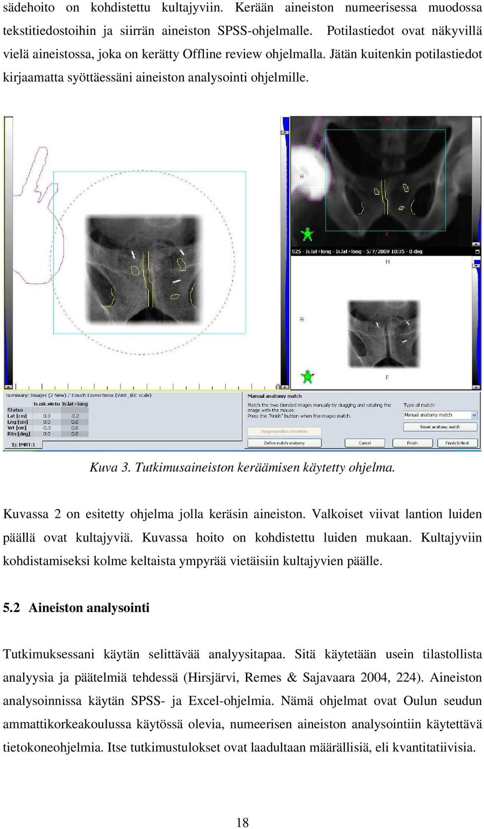 Tutkimusaineiston keräämisen käytetty ohjelma. Kuvassa 2 on esitetty ohjelma jolla keräsin aineiston. Valkoiset viivat lantion luiden päällä ovat kultajyviä.