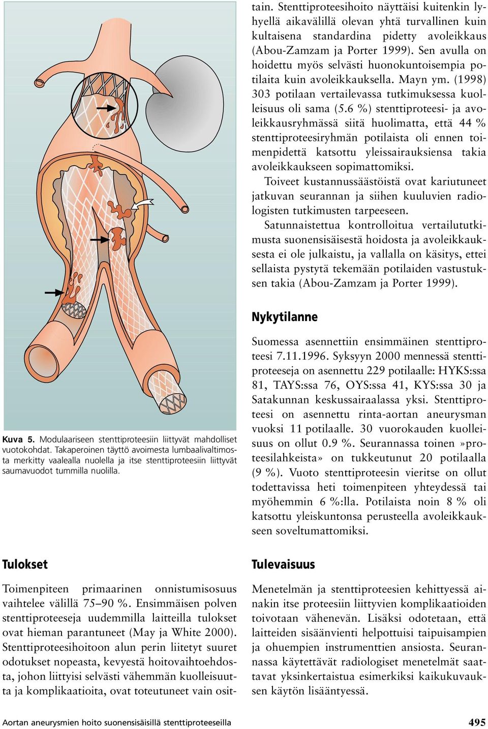 6 %) stenttiproteesi- ja avoleikkausryhmässä siitä huolimatta, että 44 % stenttiproteesiryhmän potilaista oli ennen toimenpidettä katsottu yleissairauksiensa takia avoleikkaukseen sopimattomiksi.