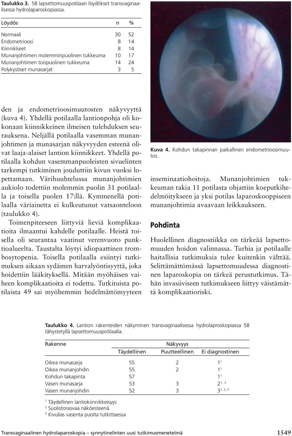 endometrioosimuutosten näkyvyyttä (kuva 4). Yhdellä potilaalla lantionpohja oli kokonaan kiinnikkeinen ilmeisen tulehduksen seurauksena.