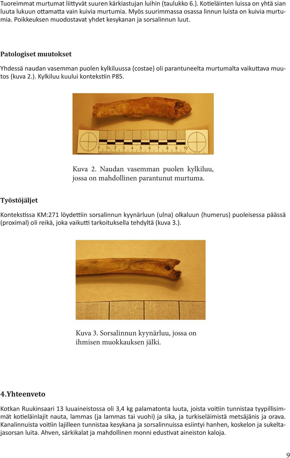 Patologiset muutokset Yhdessä naudan vasemman puolen kylkiluussa (costae) oli parantuneelta murtumalta vaikuttava muutos (kuva 2.). Kylkiluu kuului kontekstiin P85. Kuva 2.