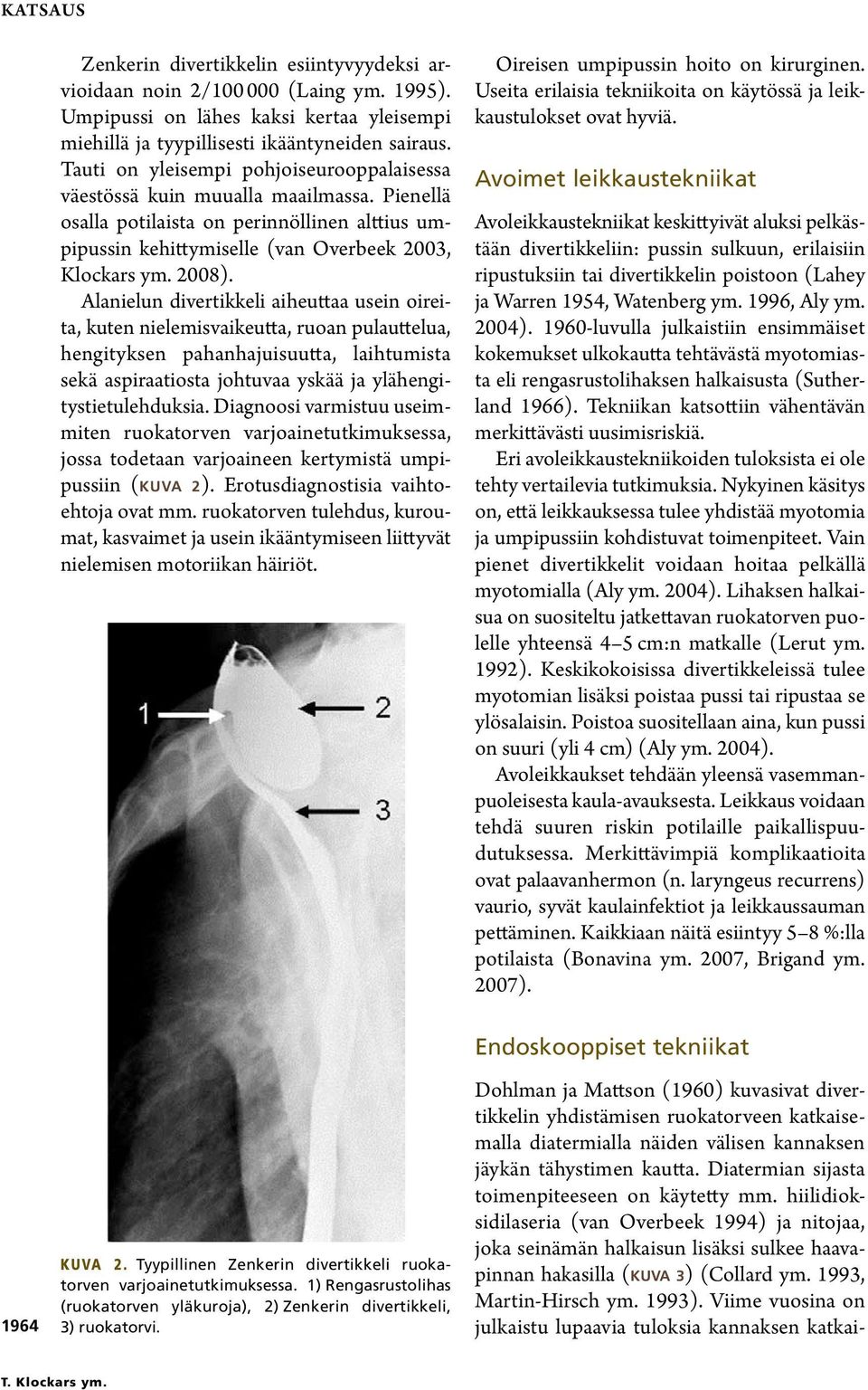 Alanielun divertikkeli aiheuttaa usein oireita, kuten nielemisvaikeutta, ruoan pulauttelua, hengityksen pahanhajuisuutta, laihtumista sekä aspiraatiosta johtuvaa yskää ja ylähengitystietulehduksia.