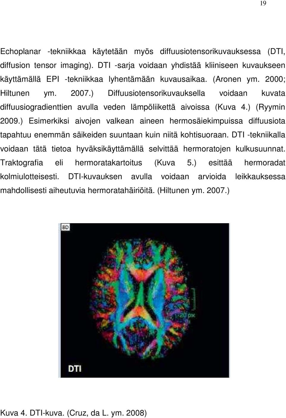 ) Diffuusiotensorikuvauksella voidaan kuvata diffuusiogradienttien avulla veden lämpöliikettä aivoissa (Kuva 4.) (Ryymin 2009.