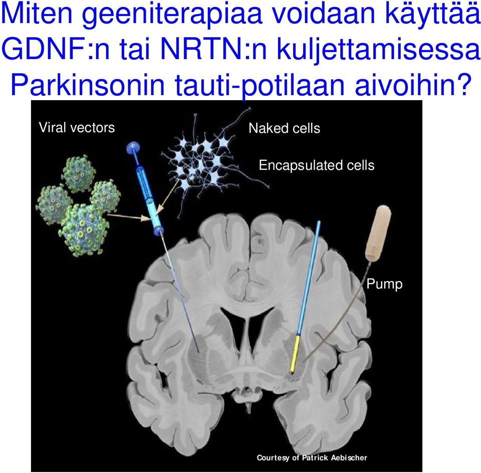 tauti-potilaan aivoihin?