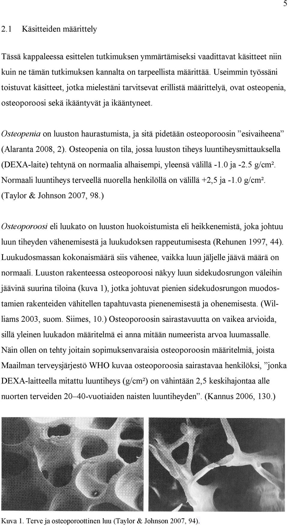 Osteopenia on luuston haurastumista, ja sitä pidetään osteoporoosin esivaiheena (Alaranta 2008, 2).