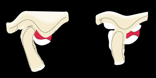 Kuvat Therapia Odontologica a) Normaali leukanivel, avauksen ja sulun yhteydessä b)