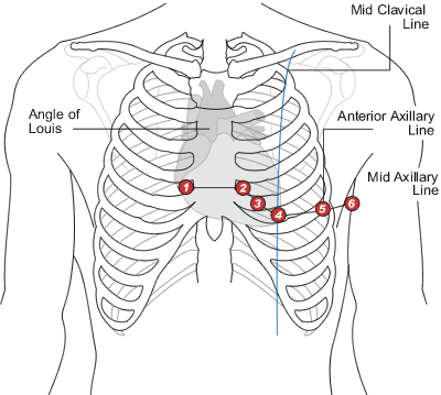 10 2.5 12-kytkentäinen EKG Kliinisessä työssä käytetään perinteisesti kahtatoista EKG-kytkentää: 6 raajakytkentää ja 6 rintakytkentää.