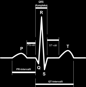 12 4 EKG-KÄYRÄN OSIEN NIMET Mahdollisten poikkeamien havaitsemiseksi on ensin tunnettava normaali, terveen ihmisen EKG- käyrä (kuva 7).