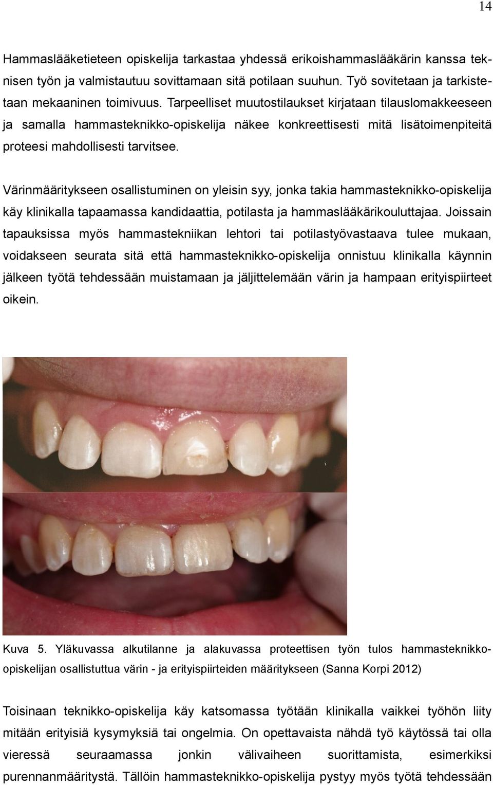 Värinmääritykseen osallistuminen on yleisin syy, jonka takia hammasteknikko-opiskelija käy klinikalla tapaamassa kandidaattia, potilasta ja hammaslääkärikouluttajaa.