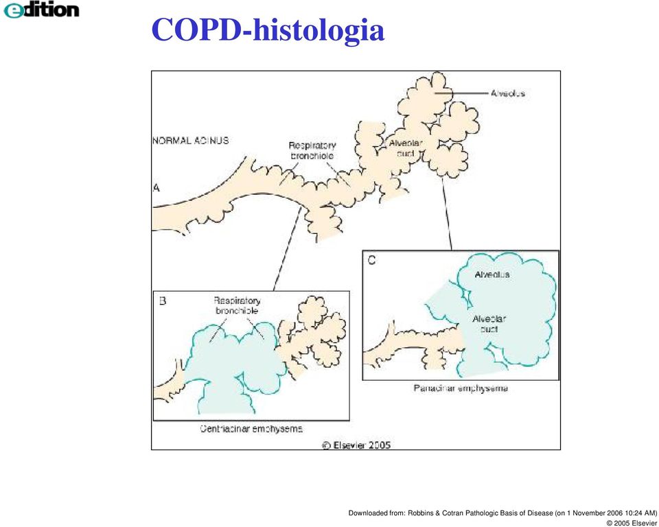 Pathologic Basis of Disease