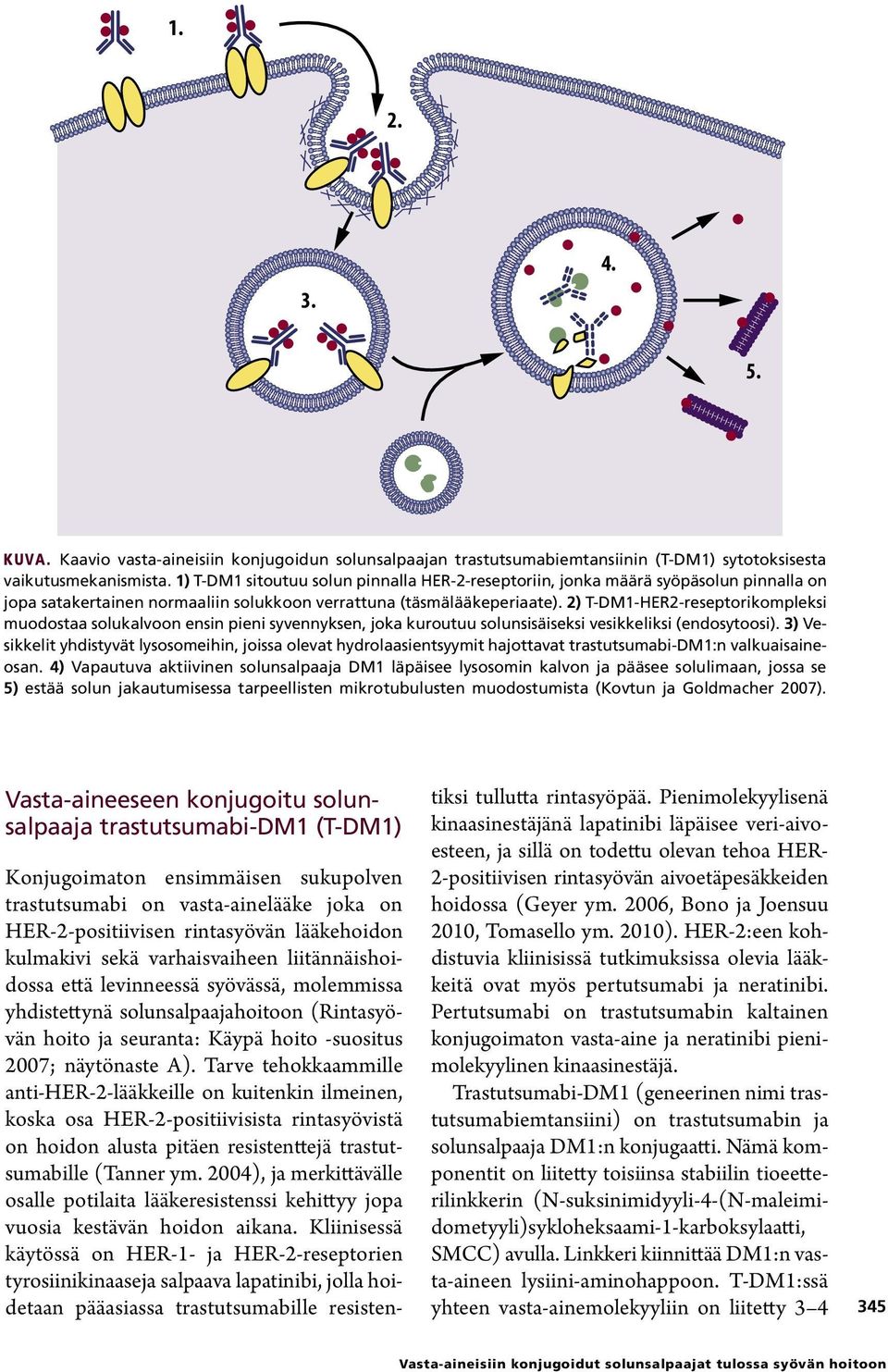 2) T-DM1-HER2-reseptorikompleksi muodostaa solukalvoon ensin pieni syvennyksen, joka kuroutuu solunsisäiseksi vesikkeliksi (endosytoosi).
