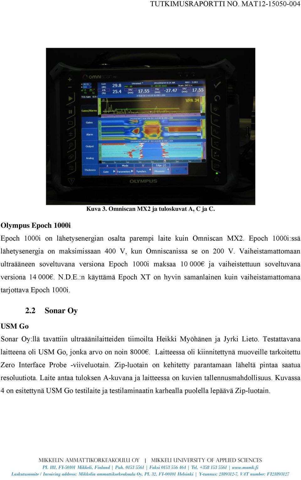 Vaiheistamattomaan ultraääneen soveltuvana versiona Epoch 1000i maksaa 10 000 ja vaiheistettuun soveltuvana versiona 14 000. N.D.E.:n käyttämä Epoch XT on hyvin samanlainen kuin vaiheistamattomana tarjottava Epoch 1000i.