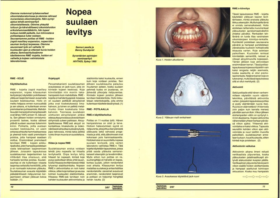 Seuraamamme ptilas li RME - hidn (rapid maxillary expansin, npea kitasauman levitys) tarpeessa. lemme seuranneet työn eri vaiheita 10 kuukauden ajan ja ttaneet kuvia hidn aikana.