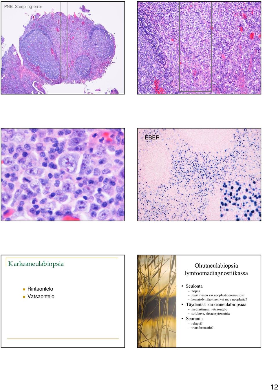 neoplastinen muutos? hematolymfaattinen vai muu neoplasia?