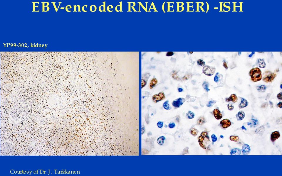 YP99-302, kidney