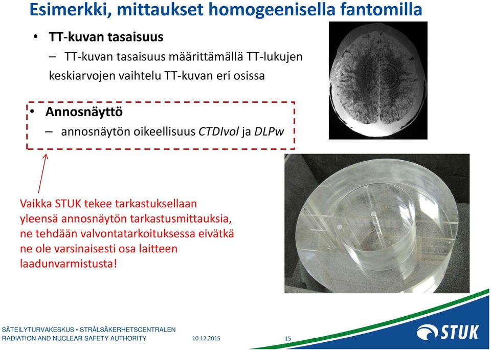 oikeellisuus CTDIvol ja DLPw Vaikka STUK tekee tarkastuksellaan yleensä annosnäytön