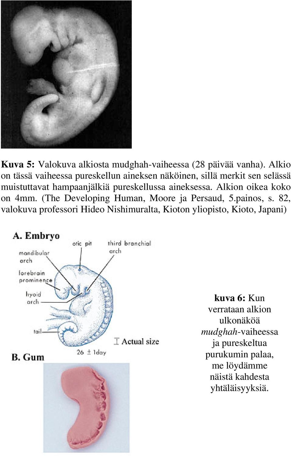 aineksessa. Alkion oikea koko on 4mm. (The Developing Human, Moore ja Persaud, 5.painos, s.