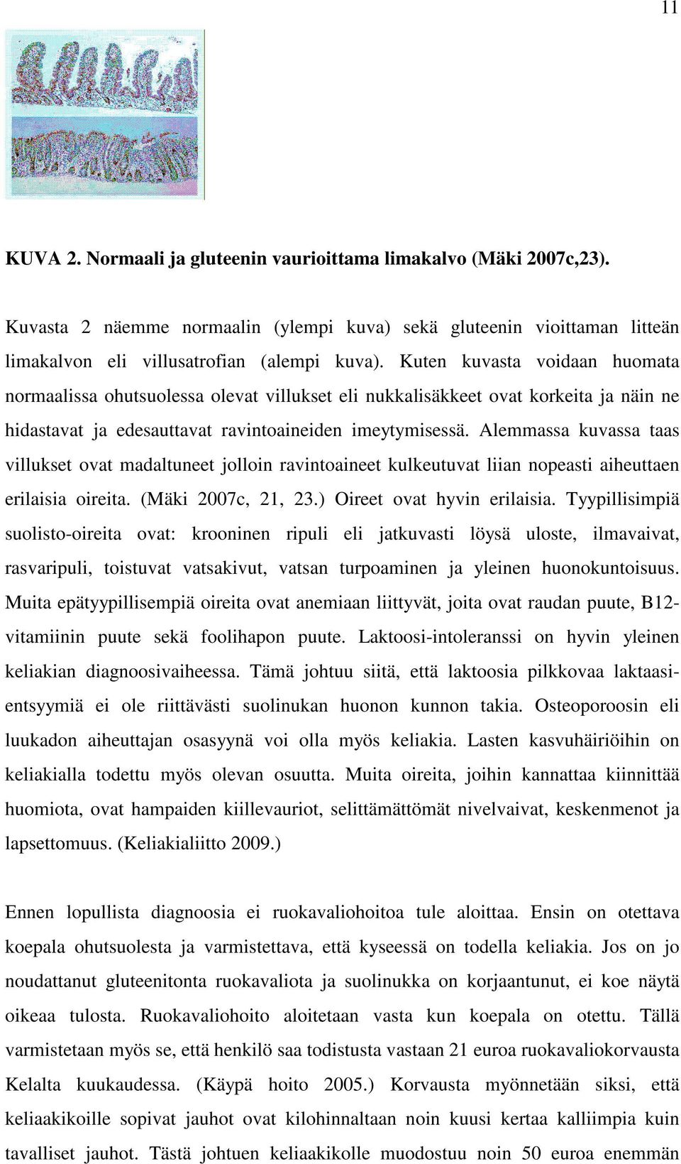 Alemmassa kuvassa taas villukset ovat madaltuneet jolloin ravintoaineet kulkeutuvat liian nopeasti aiheuttaen erilaisia oireita. (Mäki 2007c, 21, 23.) Oireet ovat hyvin erilaisia.