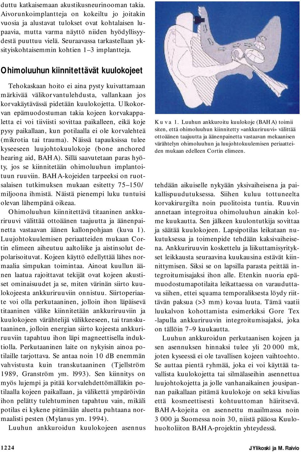 Seuraavassa tarkastellaan yksityiskohtaisemmin kohtien 1 3 implantteja.