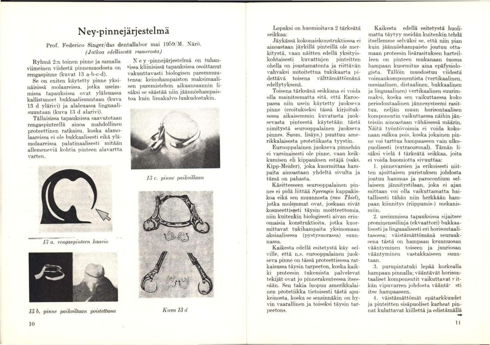 jotka useimmissa tajjauksi.ssa ovat yläleua.s.sa kallistuneet hukkaalisuuntaan (kuva 13 d ylärivi) ja alaleuassa linguaalisuuntaan (kuva 13 d alarivi).