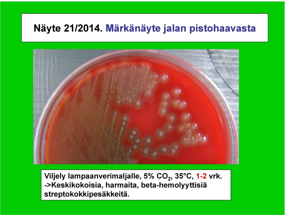 lampaanverimaljalle, 5% CO 2, 35 C, 1-2