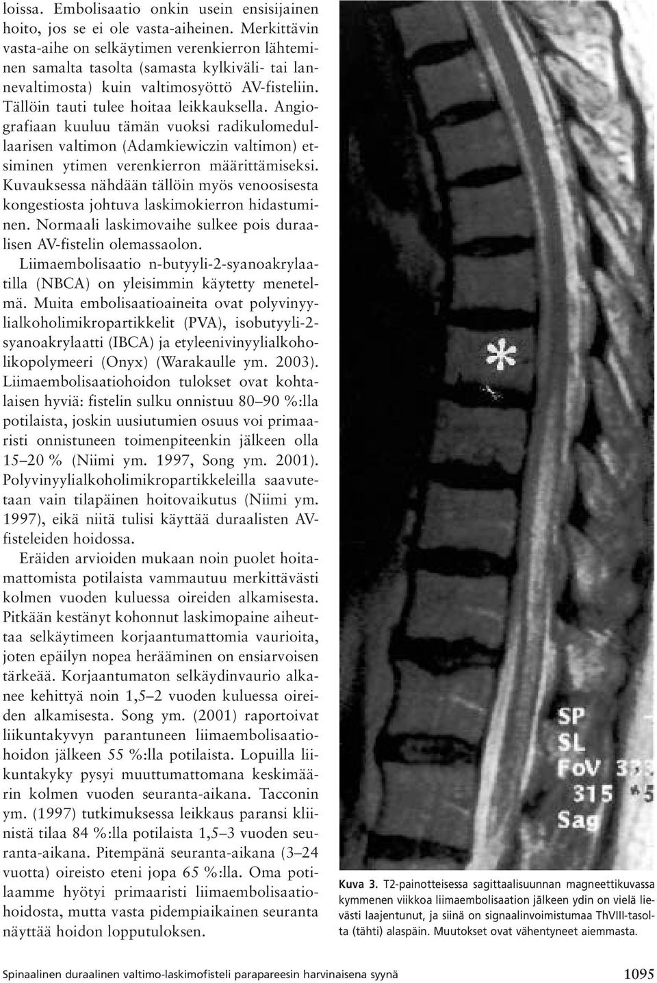 Angiografiaan kuuluu tämän vuoksi radikulomedullaarisen valtimon (Adamkiewiczin valtimon) etsiminen ytimen verenkierron määrittämiseksi.