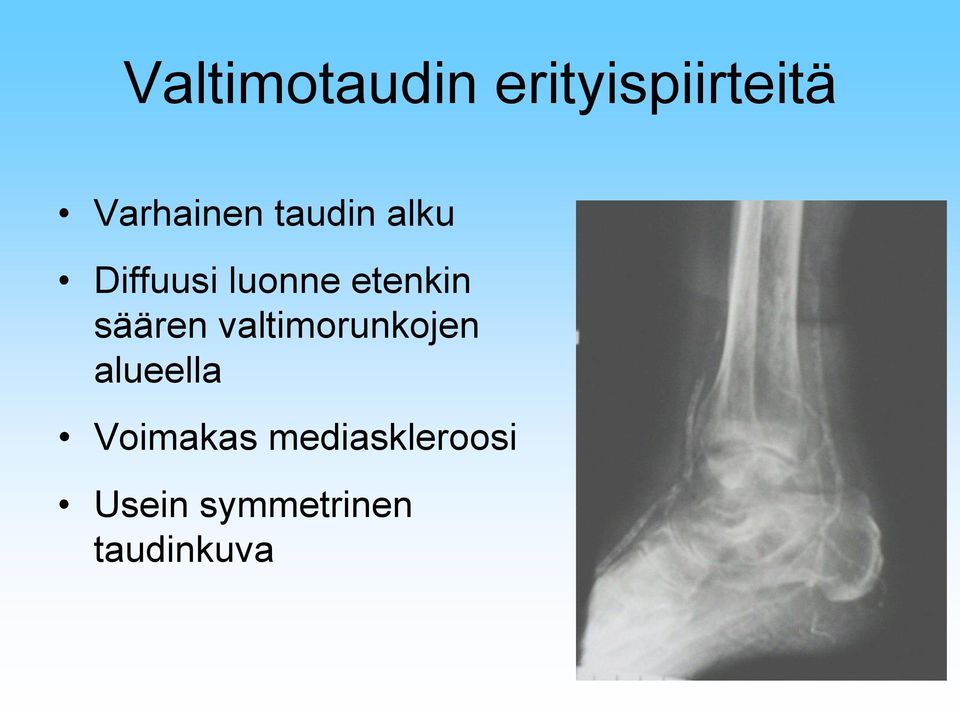 säären valtimorunkojen alueella Voimakas