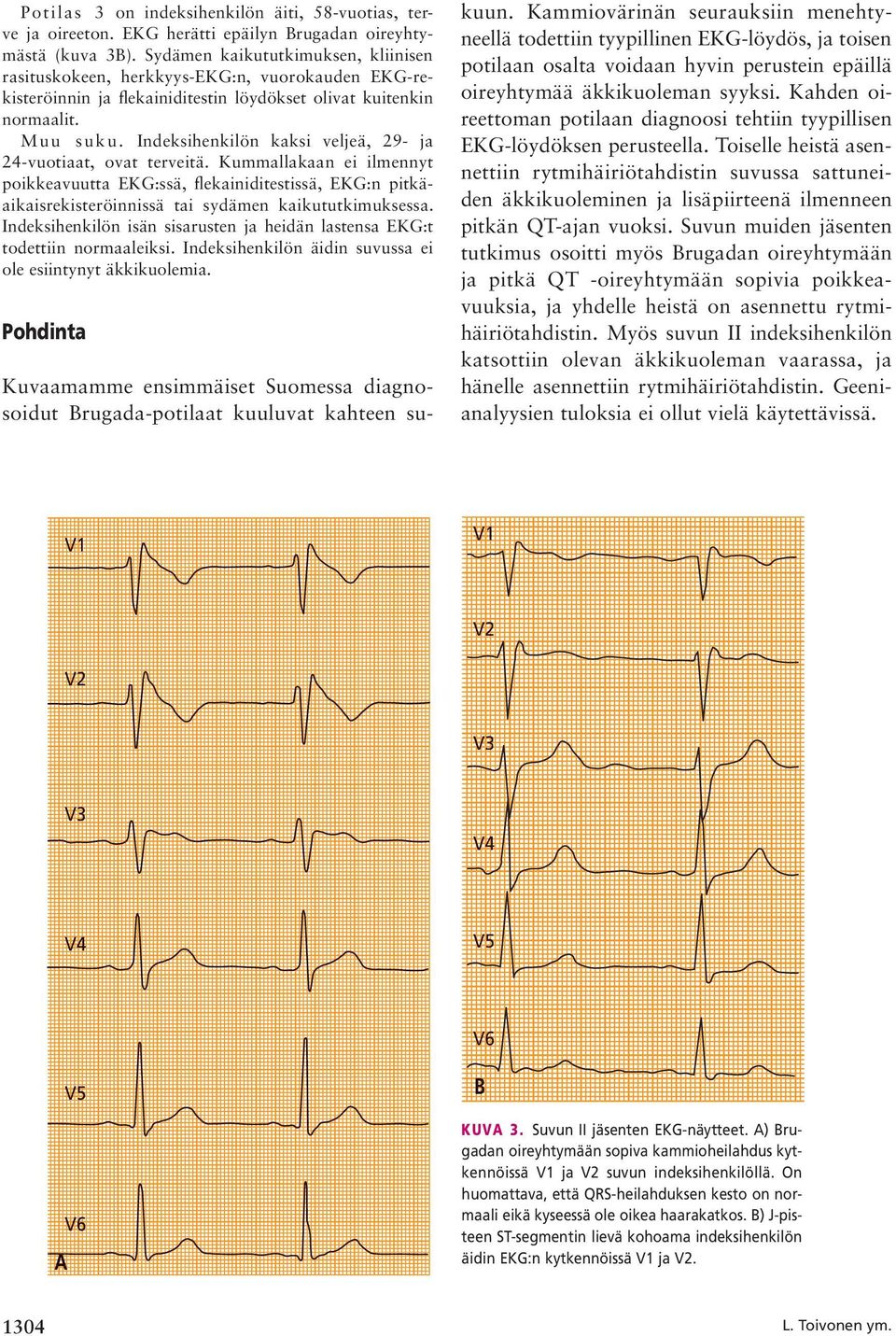 Indeksihenkilön kaksi veljeä, 29- ja 24-vuotiaat, ovat terveitä. Kummallakaan ei ilmennyt poikkeavuutta EKG:ssä, flekainiditestissä, EKG:n pitkäaikaisrekisteröinnissä tai sydämen kaikututkimuksessa.