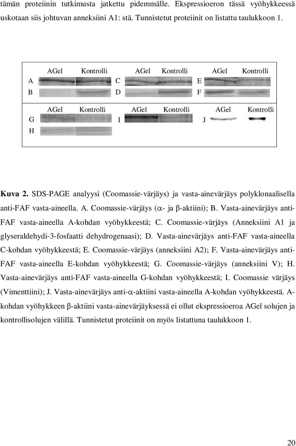 SDS-PAGE analyysi (Coomassie-värjäys) ja vasta-ainevärjäys polyklonaalisella anti-faf vasta-aineella. A. Coomassie-värjäys ( - ja -aktiini); B.