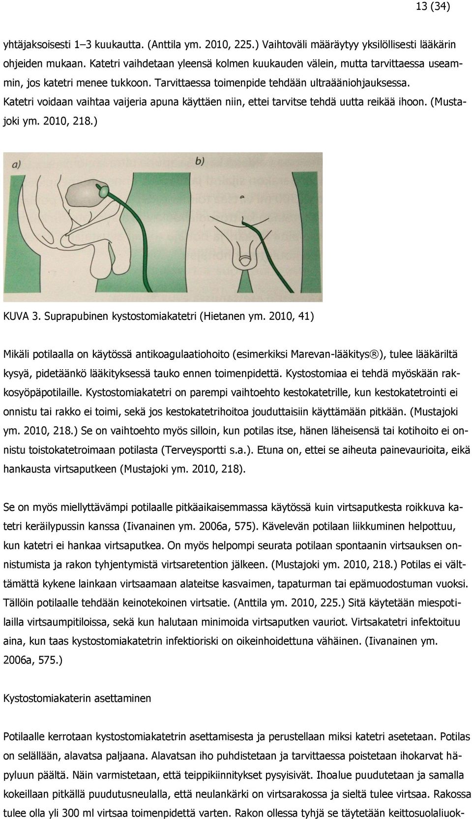 Katetri voidaan vaihtaa vaijeria apuna käyttäen niin, ettei tarvitse tehdä uutta reikää ihoon. (Mustajoki ym. 2010, 218.) KUVA 3. Suprapubinen kystostomiakatetri (Hietanen ym.