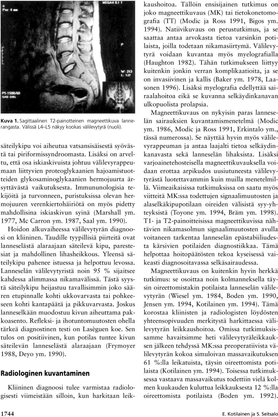 Immununologisia tekijöitä ja turvonneen, puristuksissa olevan hermojuuren verenkiertohäiriötä on myös pidetty mahdollisina iskiaskivun syinä (Marshall ym. 1977, Mc Carron ym. 1987, Saal ym. 1990).