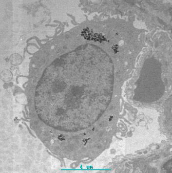 EU komission määritelmä Nanomateriaali tarkoittaa luonnollista materiaalia, sivutuote-materiaalia tai valmistettua materiaalia, joka sisältää hiukkasia joko vapaina, agglomeroituneina tai