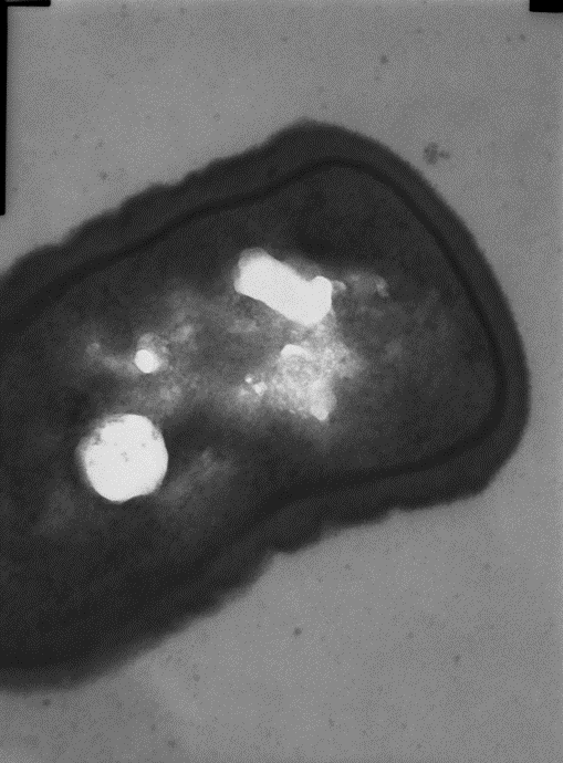 Lactobacillus Sadoittain toisistaan poikkeavia