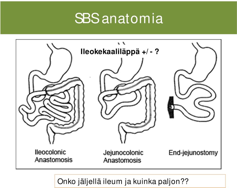 +/-? Onko jäljellä