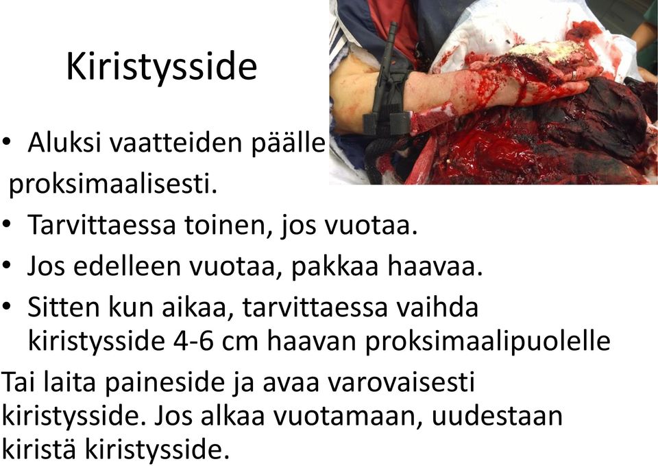 Sitten kun aikaa, tarvittaessa vaihda kiristysside 4-6 cm haavan