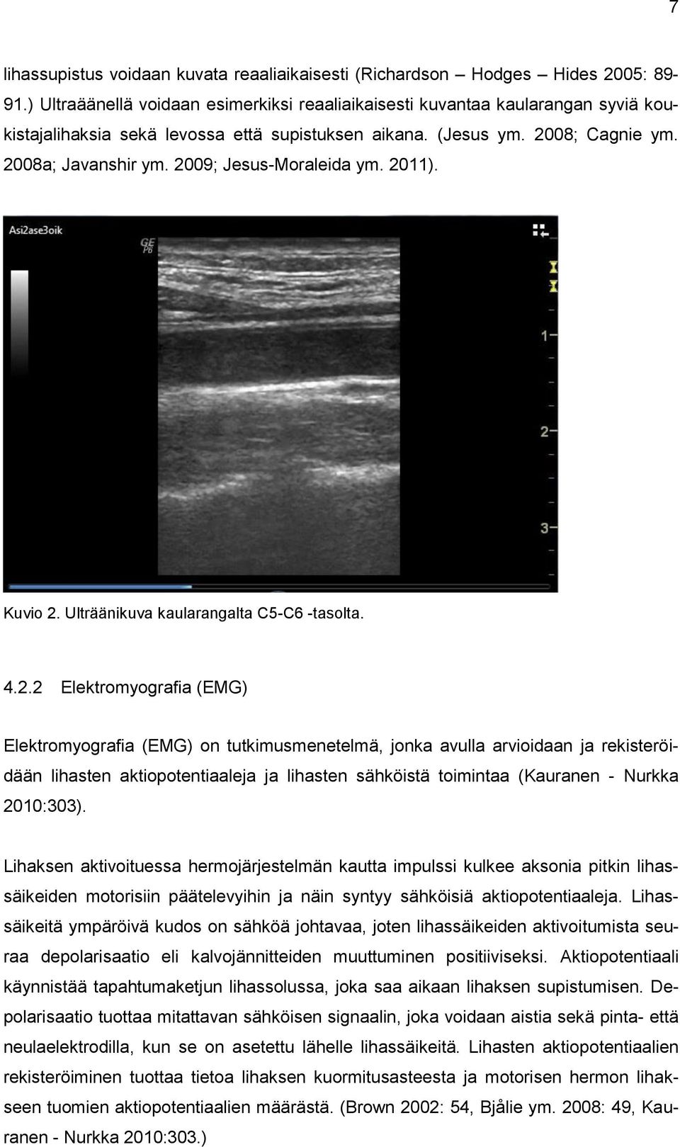 2009; Jesus-Moraleida ym. 2011). Kuvio 2. Ulträänikuva kaularangalta C5-C6 -tasolta. 4.2.2 Elektromyografia (EMG) Elektromyografia (EMG) on tutkimusmenetelmä, jonka avulla arvioidaan ja