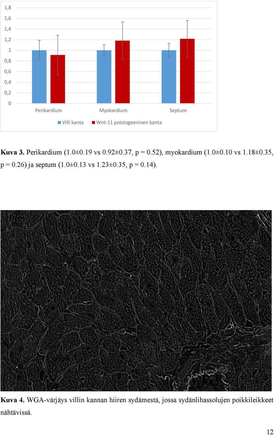 52), myokardium (1.0±0.10 vs 1.18±0.35, p = 0.26) ja septum (1.0±0.13 vs 1.23±0.