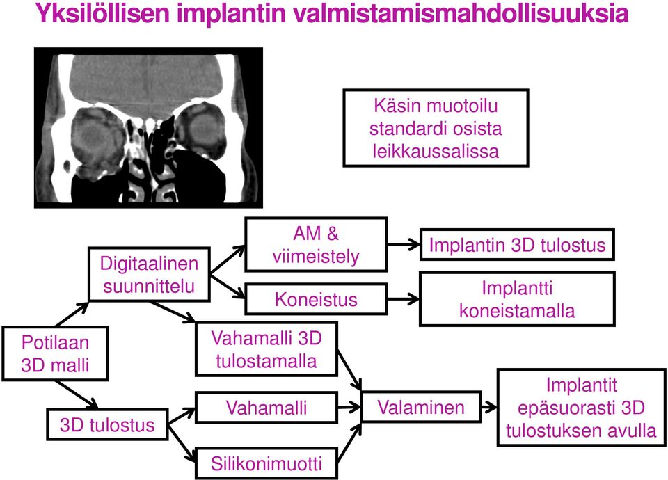 AM & viimeistely Koneistus Vahamalli 3D tulostamalla Silikonimuotti Valaminen