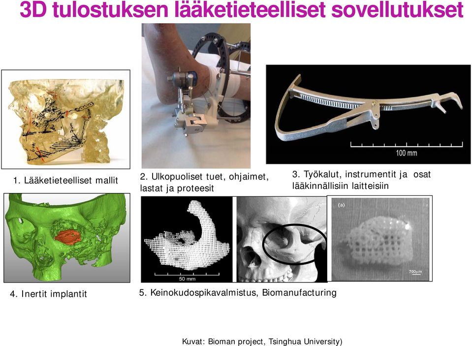 Ulkopuoliset tuet, ohjaimet, lastat ja proteesit 3.