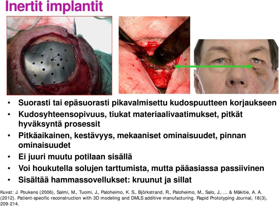 pääasiassa passiivinen Sisältää hammassovellukset: kruunut ja sillat Kuvat: J. Poukens (2006), Salmi, M., Tuomi, J., Paloheimo, K. S., Björkstrand, R.