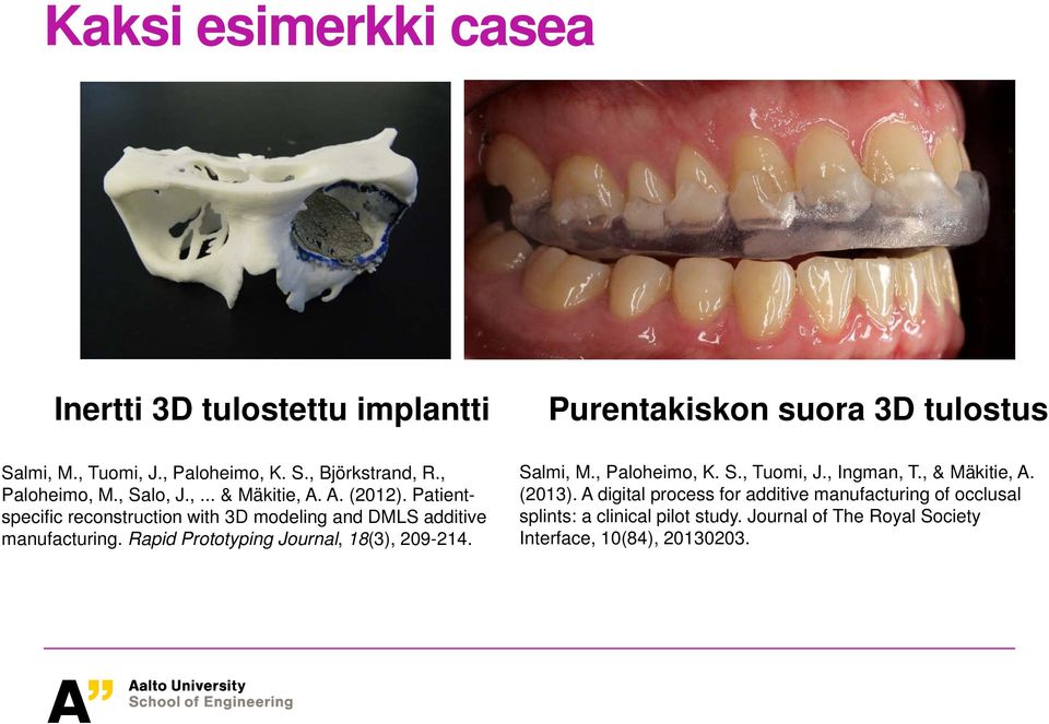 Rapid Prototyping Journal, 18(3), 209-214. Salmi, M., Paloheimo, K. S., Tuomi, J., Ingman, T., & Mäkitie, A. (2013).