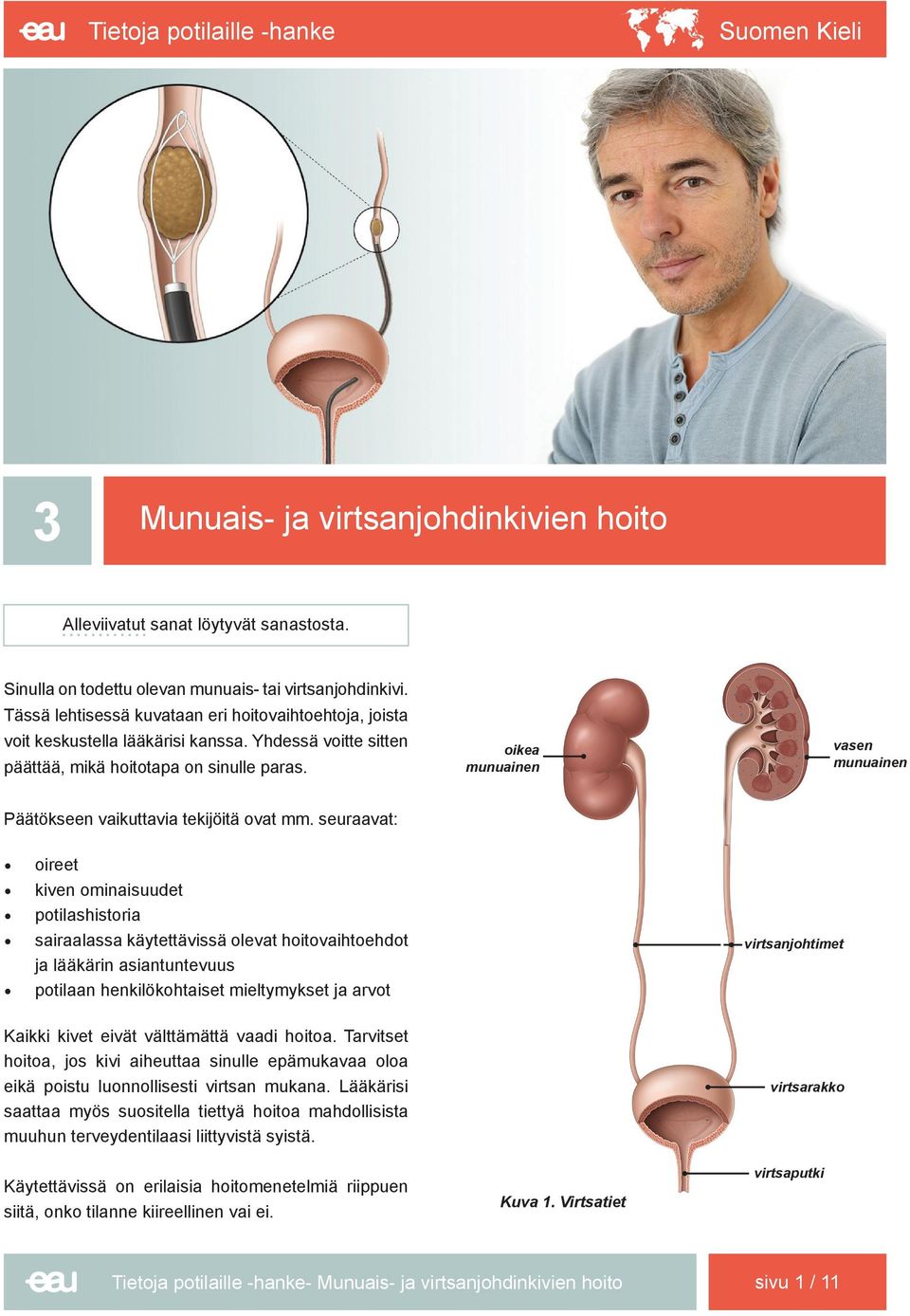 oikea munuainen vasen munuainen Päätökseen vaikuttavia tekijöitä ovat mm.