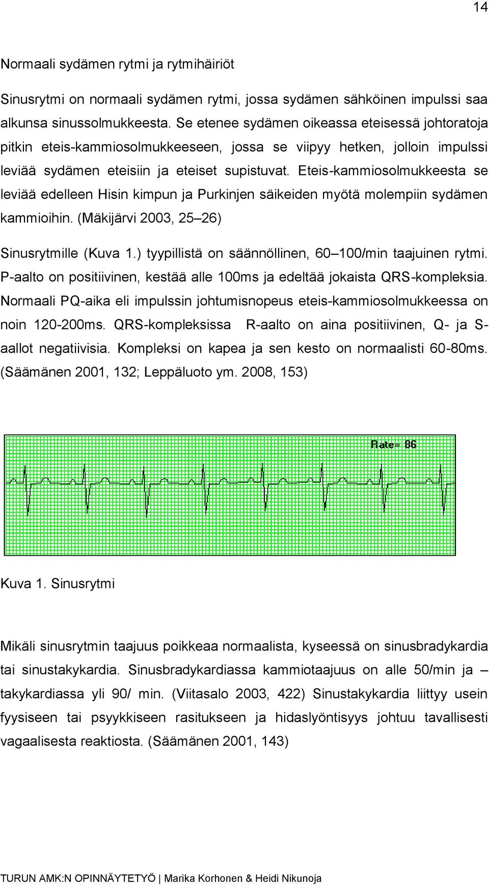 Eteis-kammiosolmukkeesta se leviää edelleen Hisin kimpun ja Purkinjen säikeiden myötä molempiin sydämen kammioihin. (Mäkijärvi 2003, 25 26) Sinusrytmille (Kuva 1.