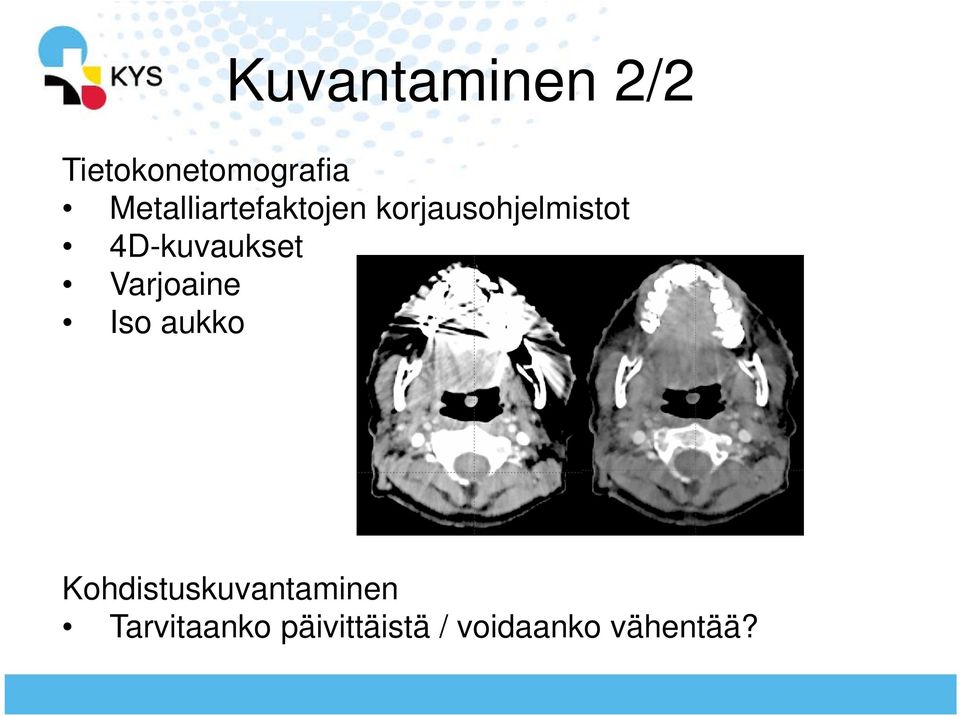 4D-kuvaukset Varjoaine Iso aukko