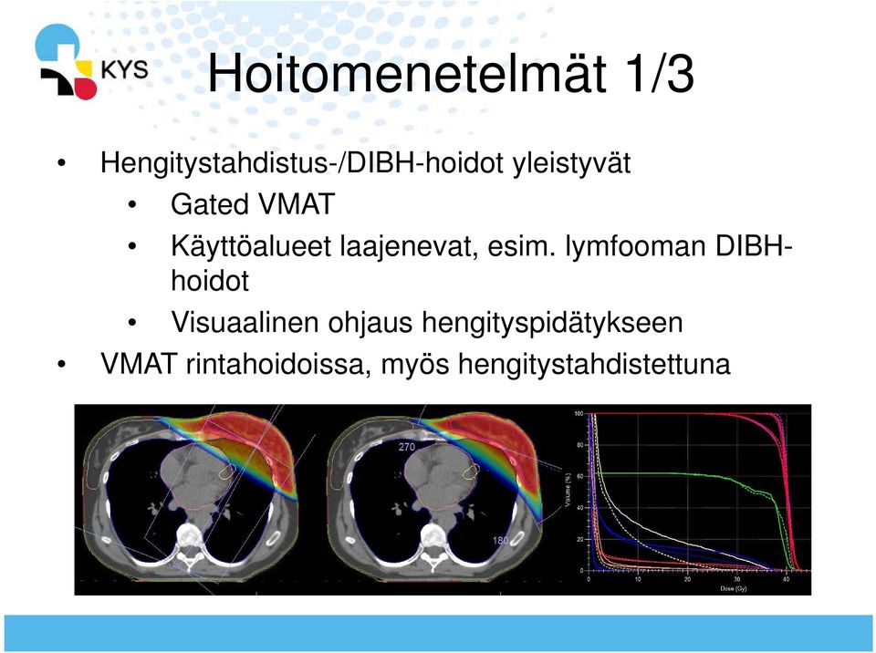 lymfooman DIBHhoidot Visuaalinen ohjaus