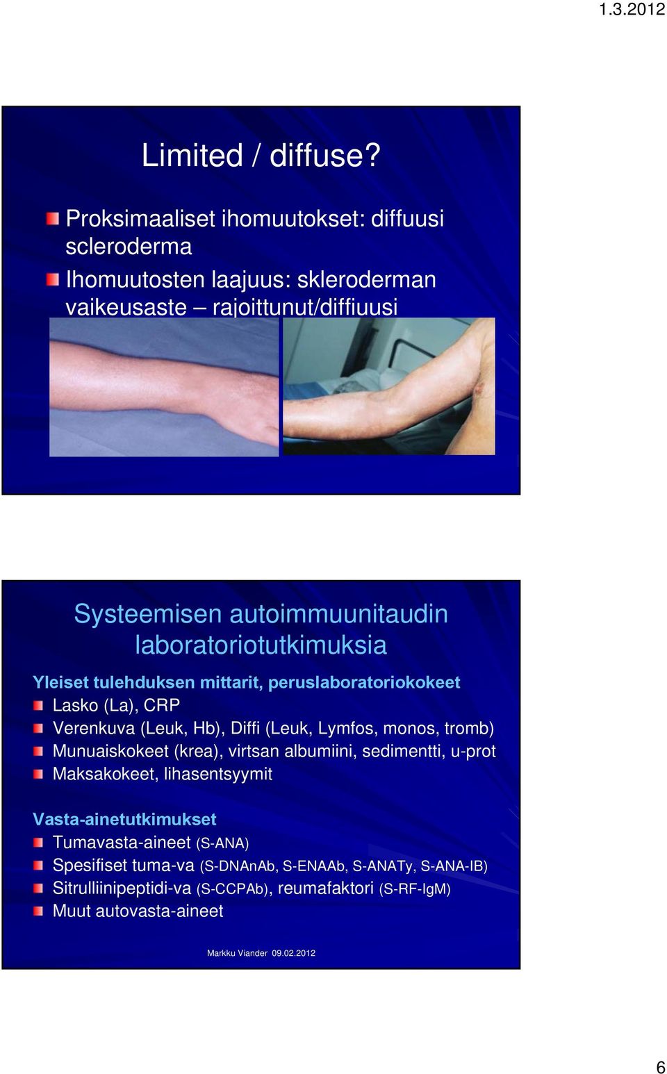 autoimmuunitaudin laboratoriotutkimuksia Yleiset tulehduksen mittarit, peruslaboratoriokokeet Lasko (La), CRP Verenkuva (Leuk, Hb), Diffi (Leuk,