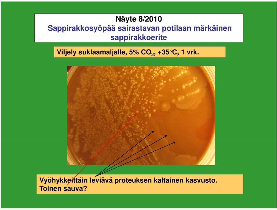 suklaamaljalle, 5% CO 2, +35 C, 1 vrk.