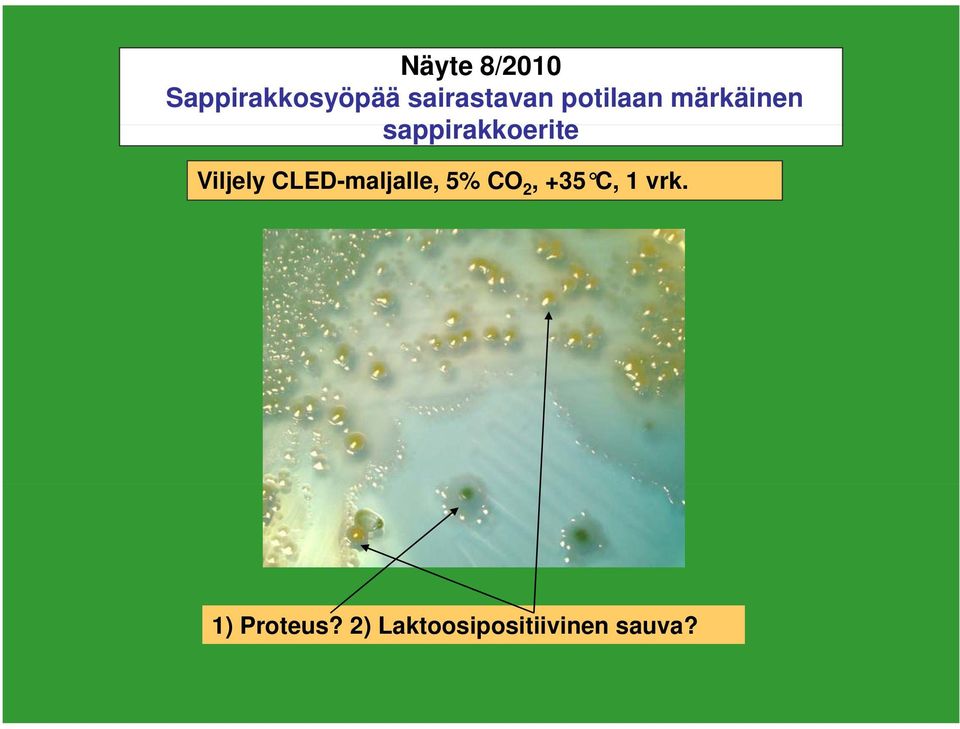 Viljely CLED-maljalle, 5% CO 2, +35 C, 1