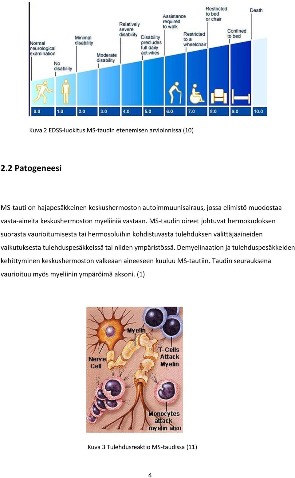 MS-taudin oireet johtuvat hermokudoksen suorasta vaurioitumisesta tai hermosoluihin kohdistuvasta tulehduksen välittäjäaineiden vaikutuksesta